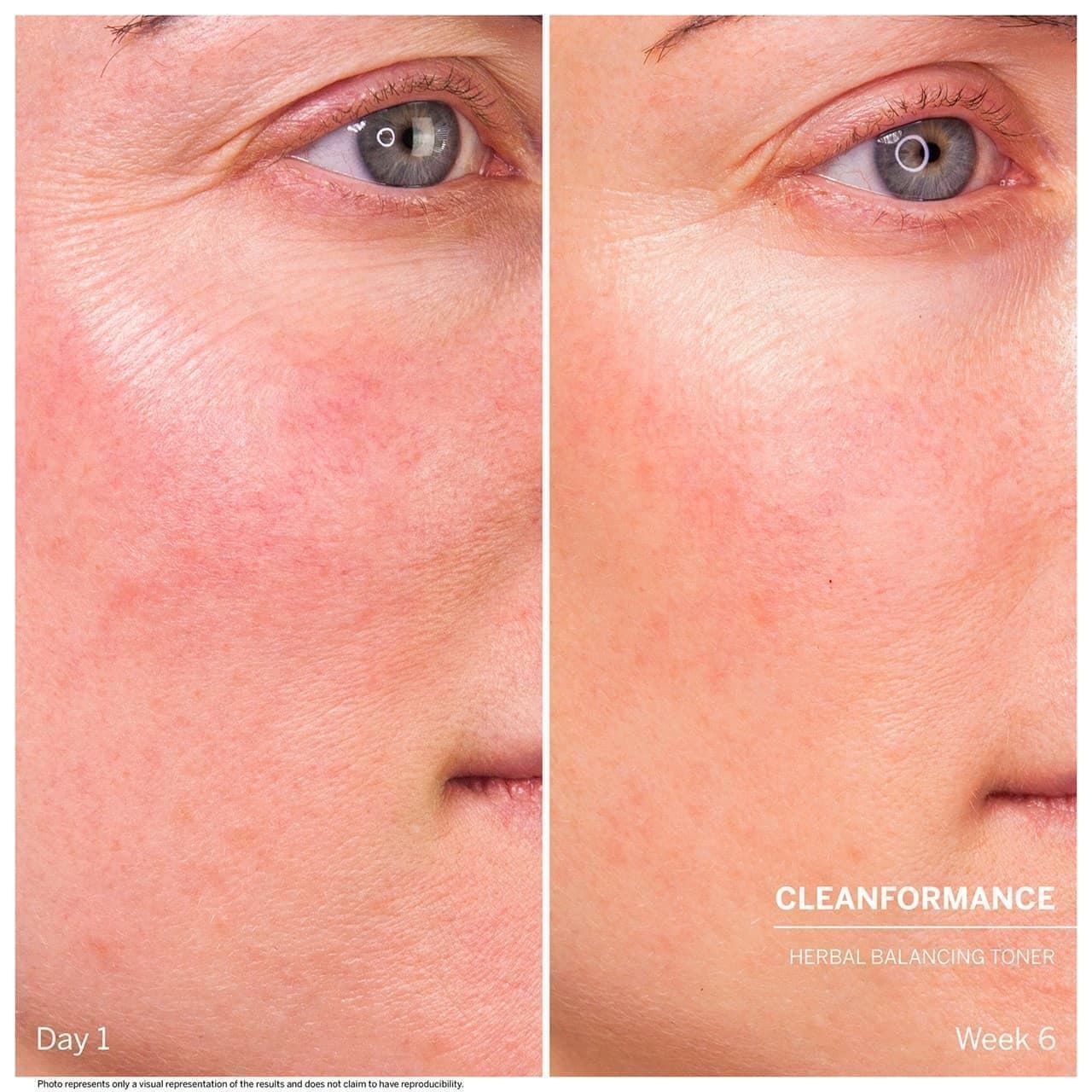 HERBAL BALANCING TONER MICROBIOMIC - Imagen 3