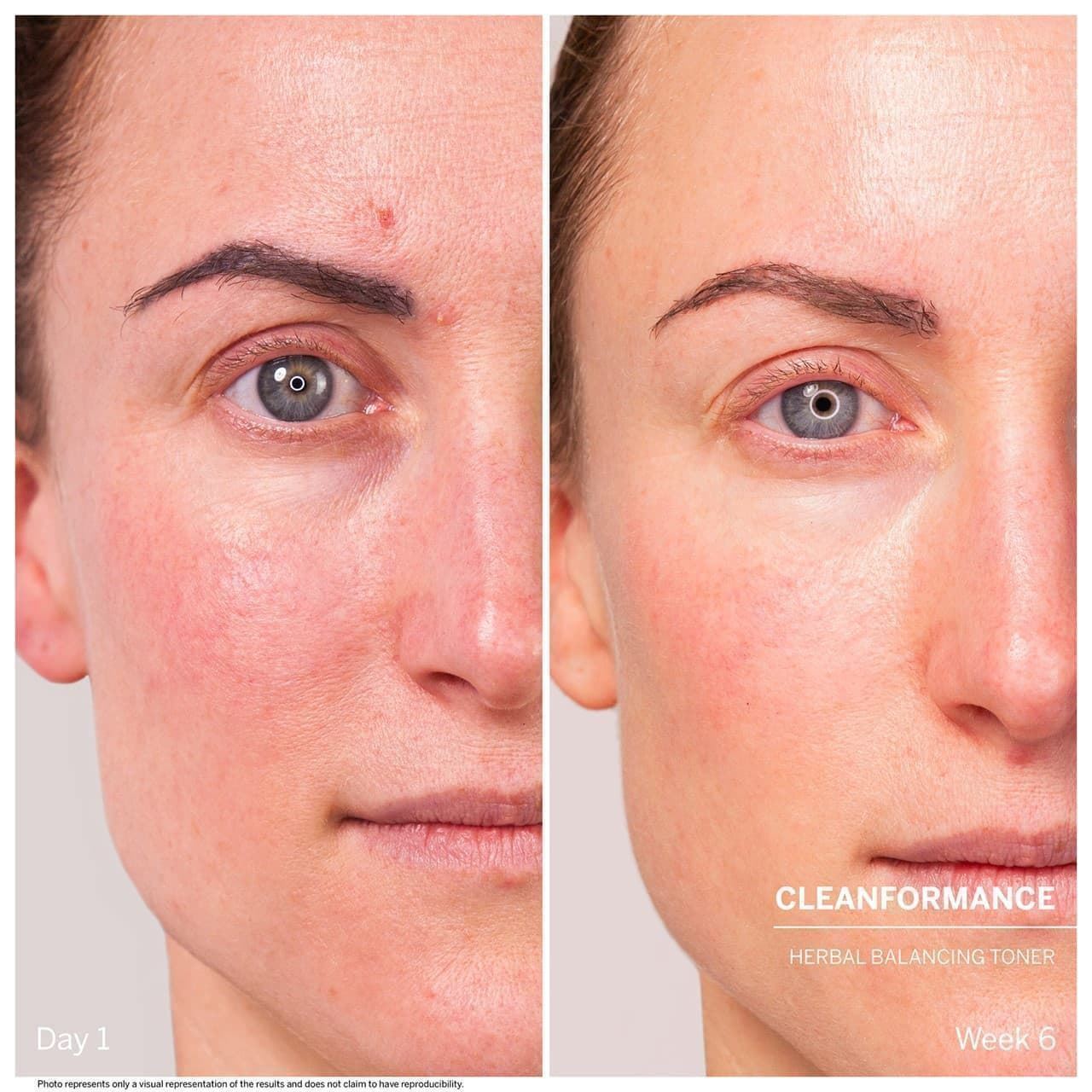HERBAL BALANCING TONER MICROBIOMIC - Imagen 4